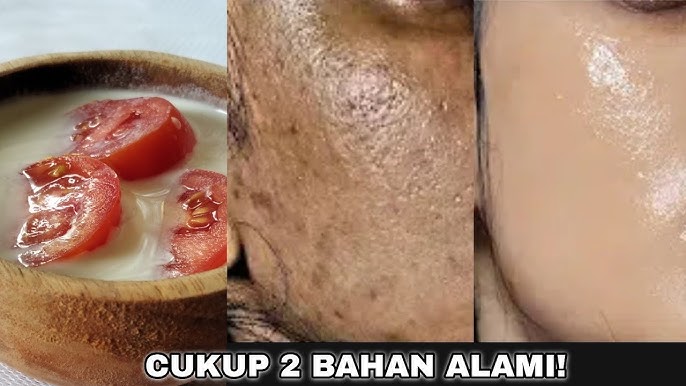 3 Cara Membuat Masker Tomat untuk Flek Hitam Agar Cepat Mengelupas