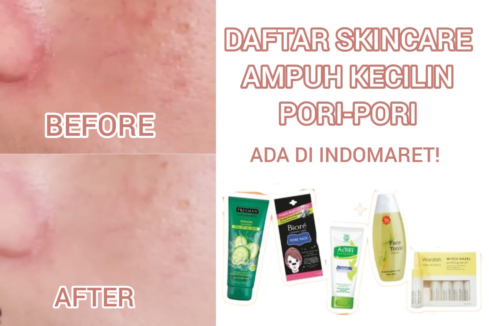 Mulai 8 Ribuan! 5 Rangkaian Lengkap Skincare Efektif Kecilin Pori Sekaligus Angkat Komedo, Ada di Indomaret!