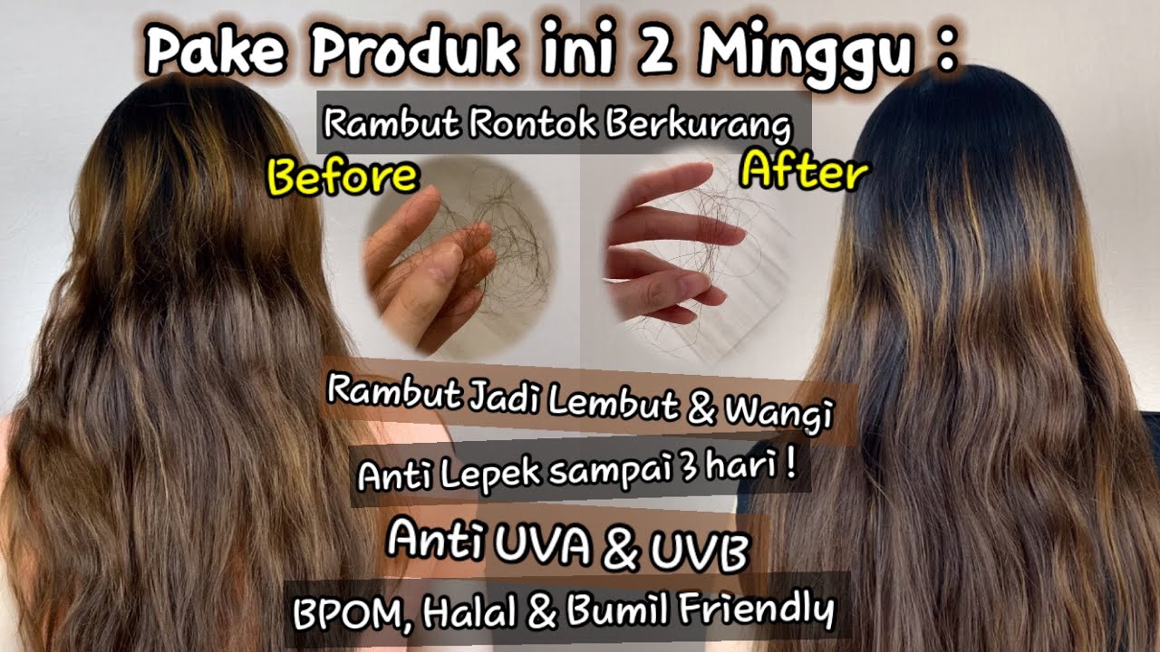 4 Vitamin untuk Rambut Rontok, Ampuh Usir Ketombe dan Lepek Gak Pakai Lama