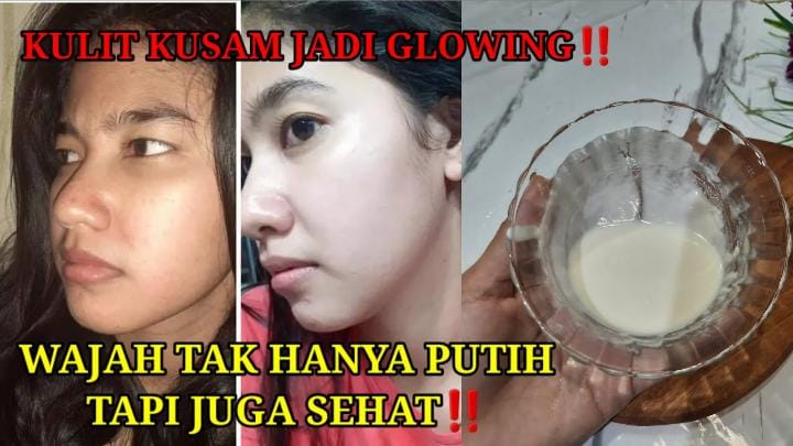 4 Cara Membuat Masker Madu Sesuai dengan Jenis Kulit, Ampuh Memutihkan dan Cegah Flek Hitam Juga Kerutan