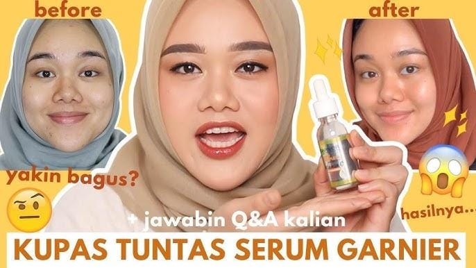 4 Serum Garnier untuk Flek Hitam dalam 3 Hari, Efektif Bikin Kulit Cerah dan Glowing Bebas Noda Dengan Cepat