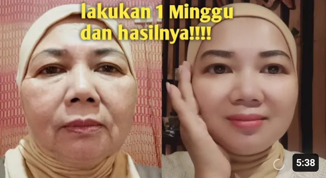 5 Skincare untuk Menghilangkan Kerutan dan Flek Hitam! Bikin Awet Muda  Hanya dengan 1 Produk, Ga