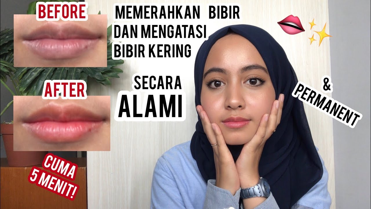 5 Cara Alami Agar Bibir Pink dan Sehat untuk Mengatasi Bibir yang Kering dan Gelap