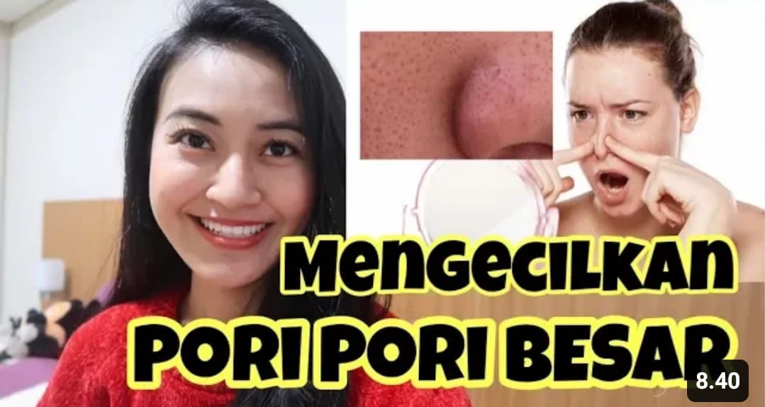 Inilah 3 Skincare untuk Pori Besar dan Komedo Terbaik! Produk Termurah Bikin Wajah Mulus, Ada di Indomaret