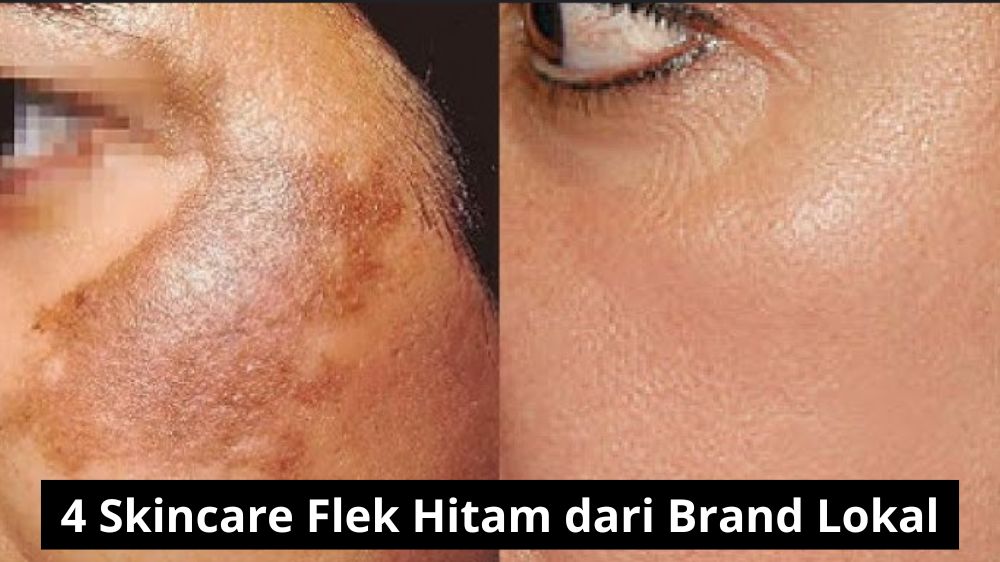 4 Skincare Flek Hitam dari Brand Lokal, Rekomendasi Terbaik untuk Wajah Glowing dan Awet Muda