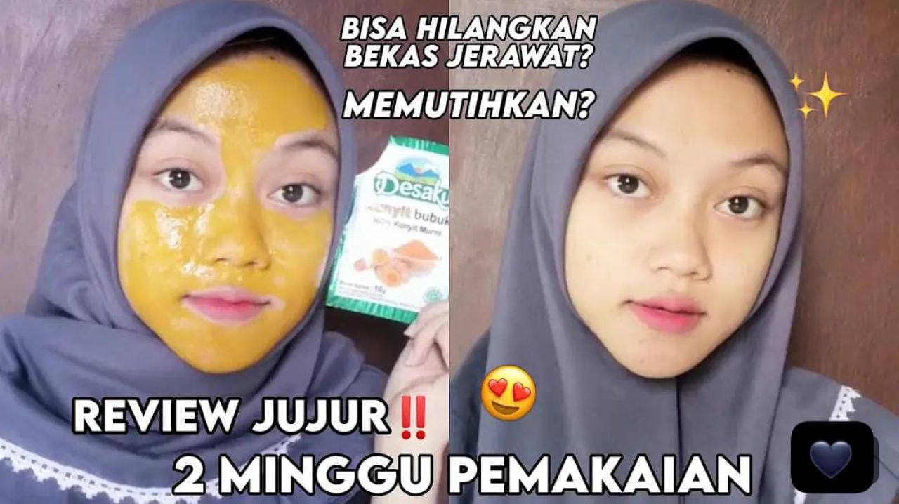 Diy Masker Kunyit untuk Menghilangkan Flek Hitam di Wajah Dalam 1 Malam, Begini 3 Cara Raciknya