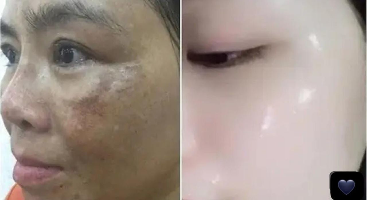 2 DIY Masker Bengkoang untuk Menghilangkan Flek Hitam dan Memutihkan Wajah, Bikin Kulit Glowing!