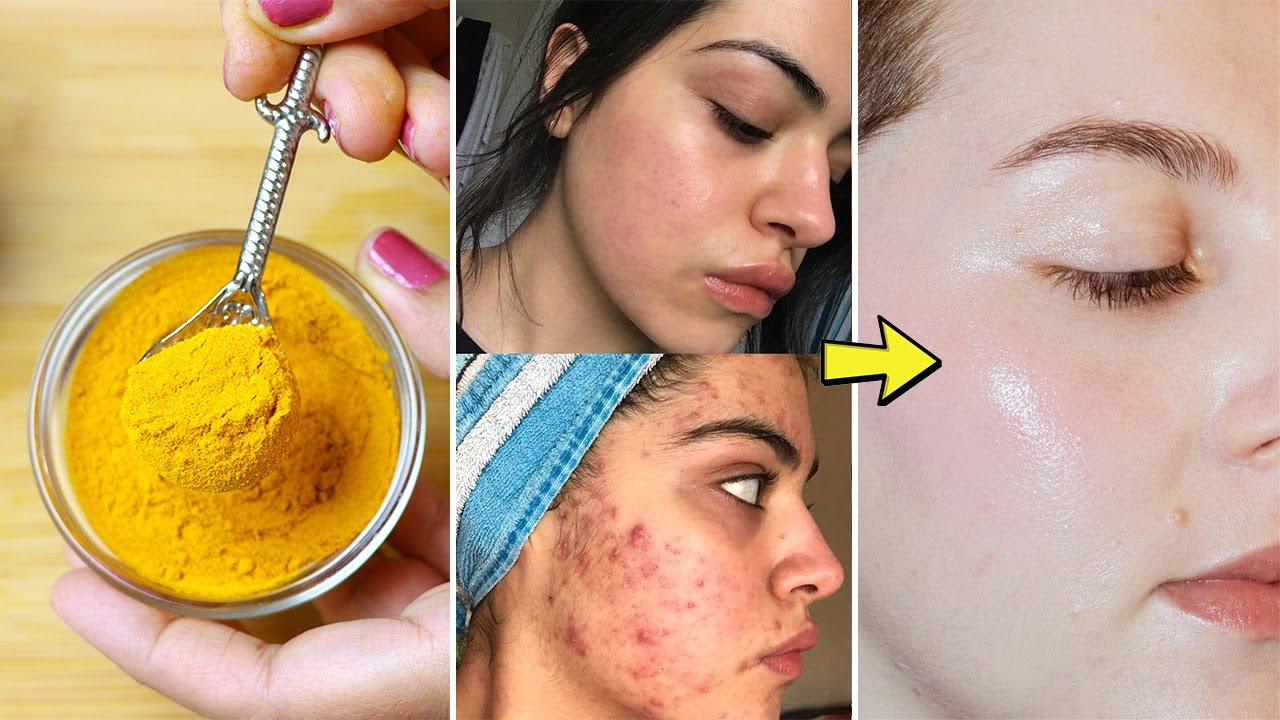 Begini Cara Memutihkan Wajah Dengan Masker Kolagen Alami, Cuma Modal Bahan Dapur Bikin Glowing Awet Muda