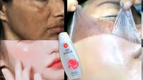 Begini Cara Pakai Air Mawar di Muka Agar Glowing dan Cerah Seketika, Cuma 3 Langkah!