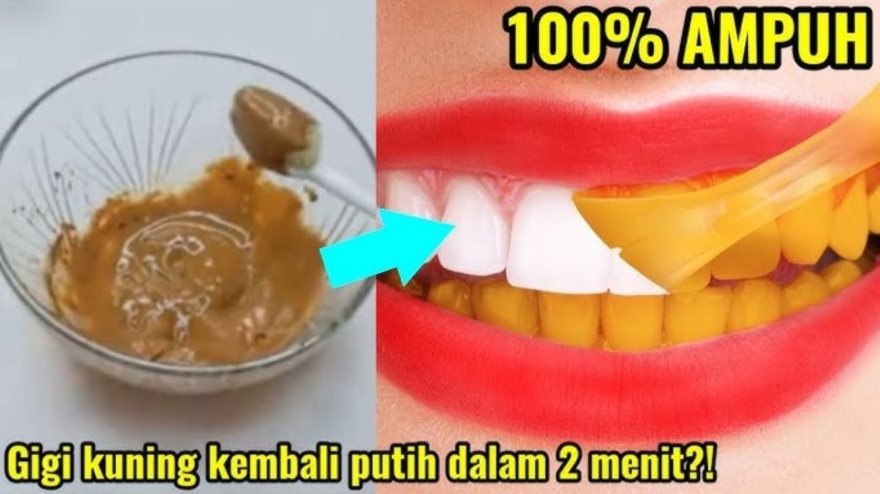 4 Daftar Bahan Alami Pemutih Gigi Kuning, Begini Cara Mudah Menggunakannya 