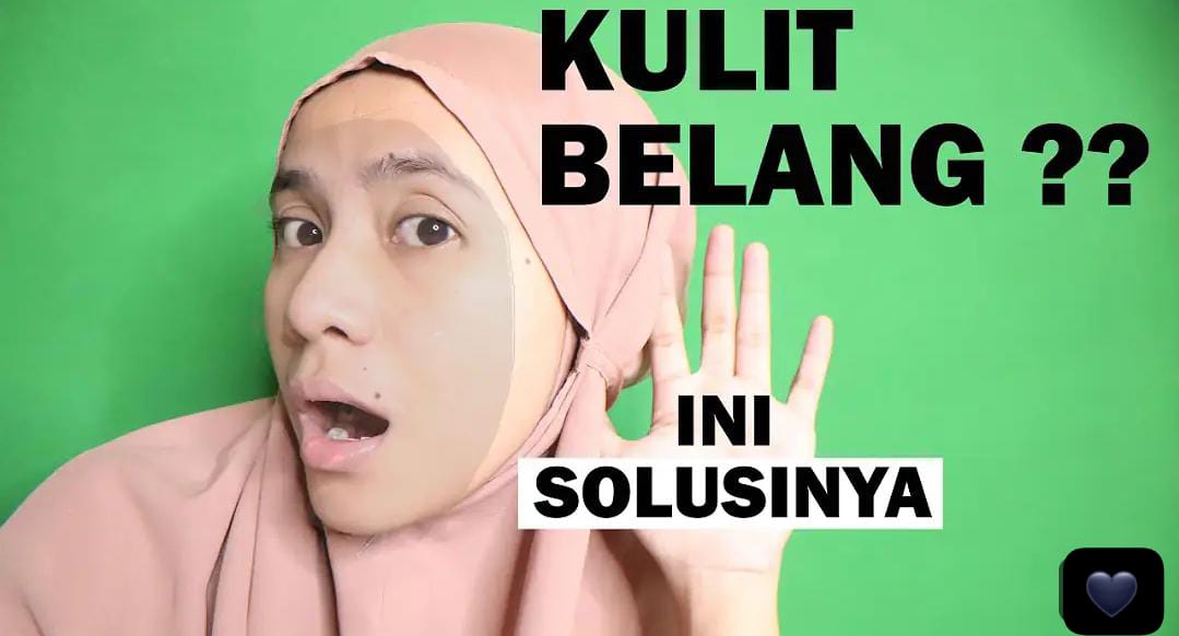 4 Cara Menghilangkan Belang di Muka Dengan Cepat Secara Alami