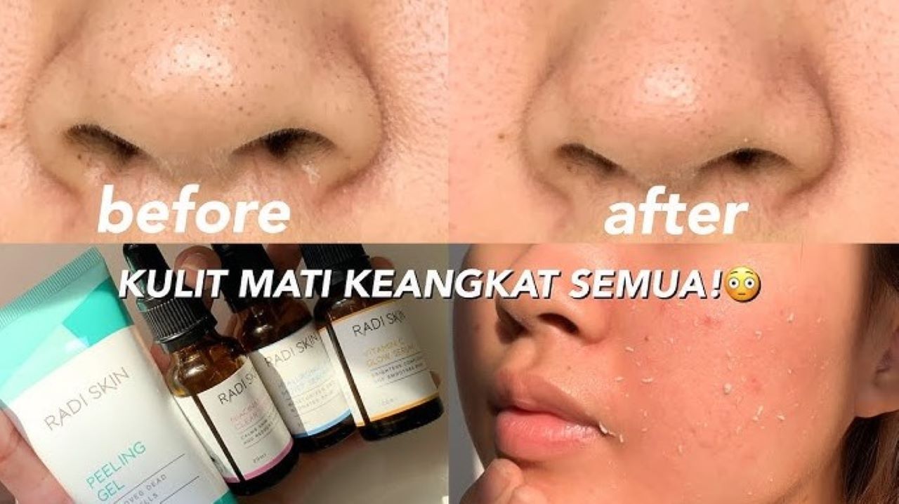 4 Merk Peeling Gel untuk Mengecilkan Pori-Pori, Angkat Sel Kulit Mati Bikin Wajah Cerah Merata