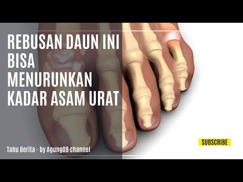 Inilah Rebusan Daun untuk Menurunkan Kadar Asam Urat secara Cepat dan Alami, Bisa Menyehatkan Tubuh