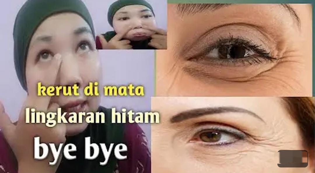 3 Cara Alami Menghilangkan Kantung Mata yang Kendur dan Hitam, Cuma Pakai Bahan Dapur Kulit jadi Cerah Merata