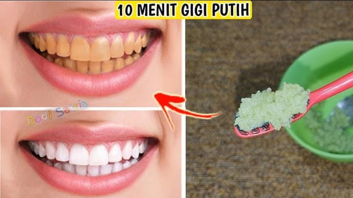 Begini Cara Memutihkan Gigi Kuning dengan 3 Jenis Buah, Bikin Gigi Bersih Bebas Noda dan Plak Gak Pakai Lama