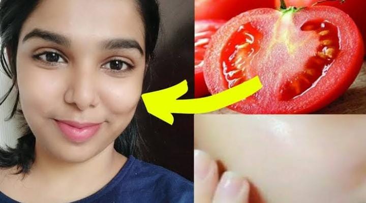 Cara Cepat Menghilangkan Flek Hitam Menahun dengan Tomat dalam 1 Hari, Wajah Glowing Permanen Plus Awet Muda