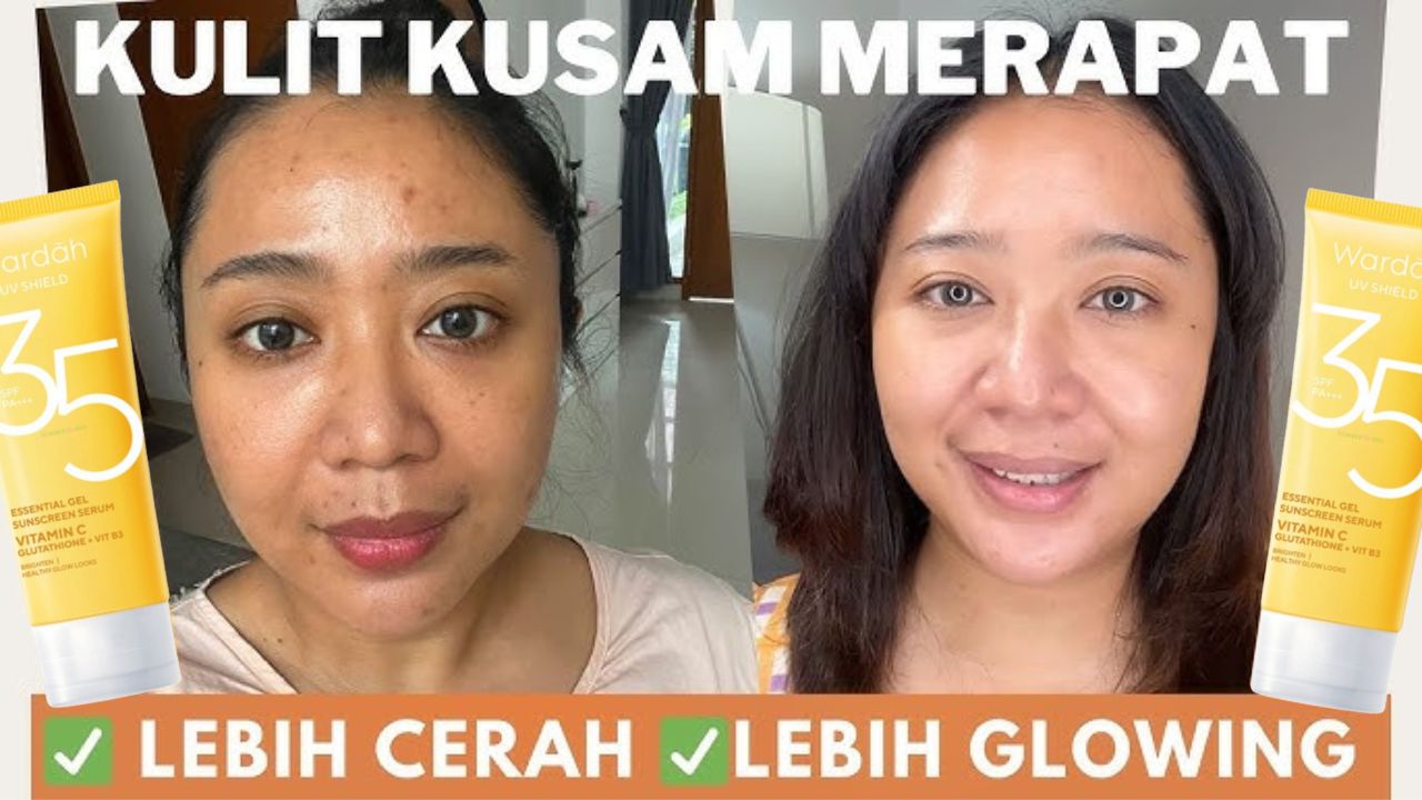 3 Sunscreen untuk Menghilangkan Flek Hitam Terbaik di Indomaret, Bikin Glowing Awet Muda Bebas Noda