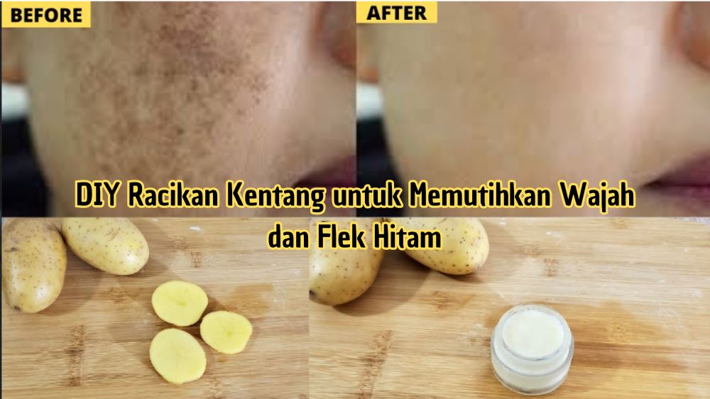 DIY Racikan Kentang untuk Memutihkan Wajah dan Flek Hitam, Rahasia Glowing dalam 5 Langkah