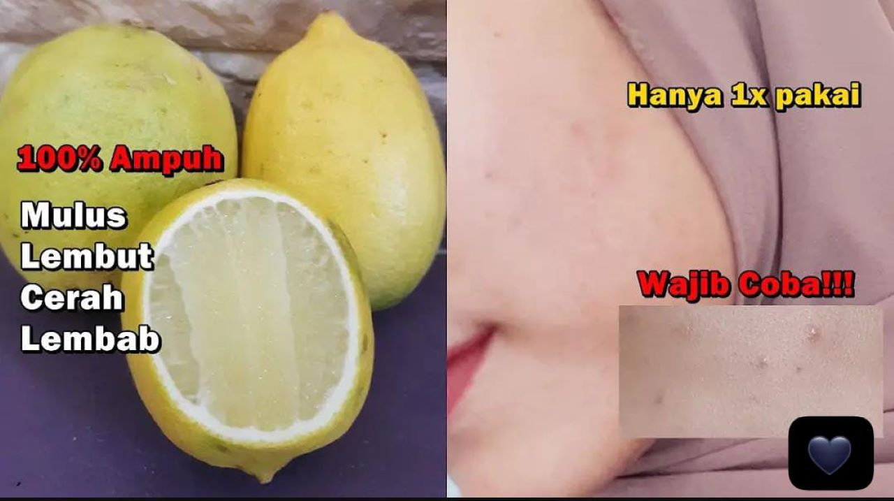 3 Metode Pakai Lemon untuk Wajah Usia 40 Tahun Ke Atas Agar Bebas Flek Hitam dan Kerutan