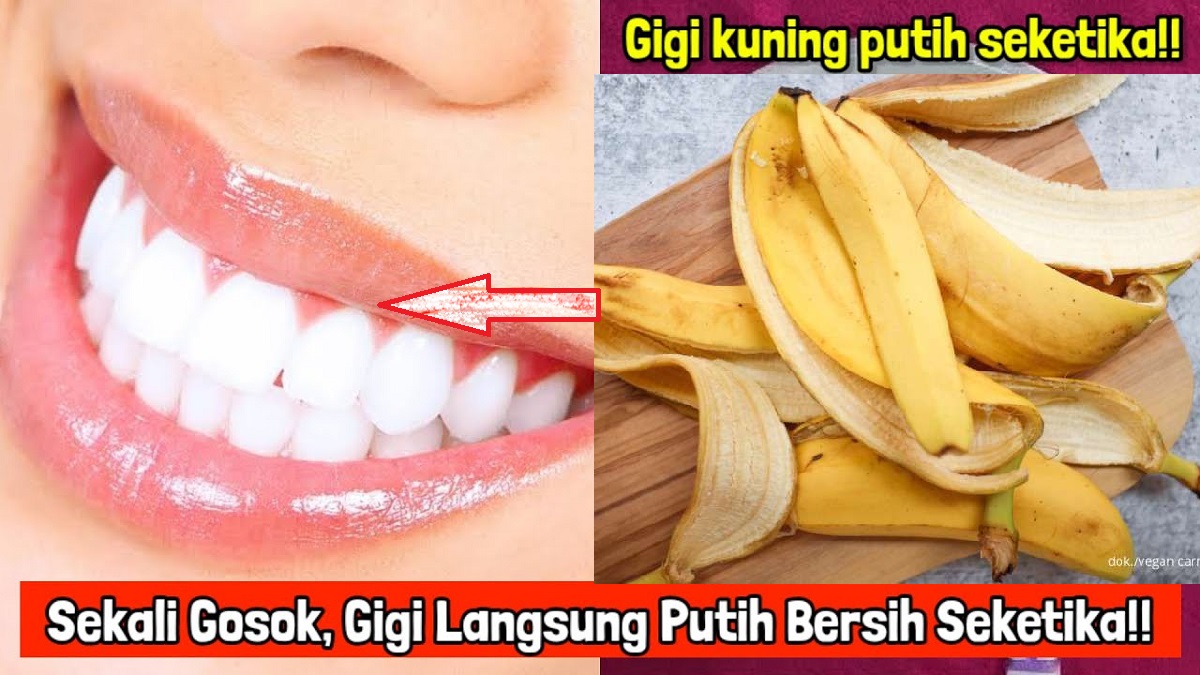 Sangat Ampuh untuk Memutihkan Gigi dengan Kulit Pisang dan Garam Dapur, Begini Cara Praktis Mudah dan Ekonomis