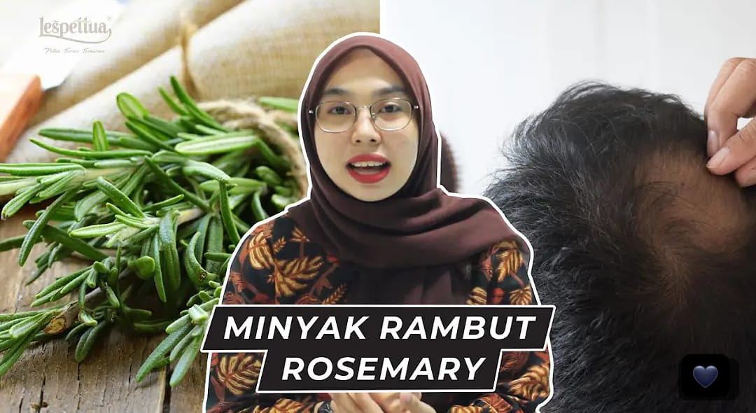 Cara Pakai Minyak Rosemary untuk Menumbuhkan Rambut dan Mengatasi Ketombe