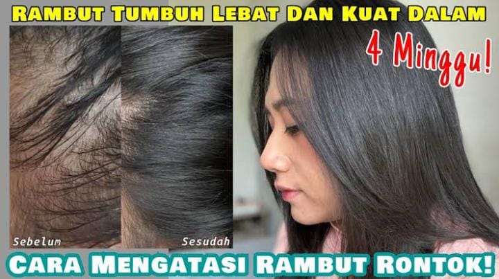 7 Cara Mengatasi Rambut Rontok di Usia Muda, Ampuh Bikin Rambut Kuat Anti Patah Cuma Pakai Bahan Alami Saja