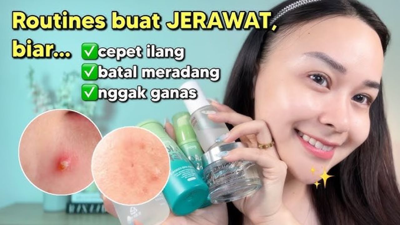 5 Rekomendasi Produk Skincare Routine untuk Kulit Berjerawat, Hasil Signifikan Tampak dalam 25 Hari
