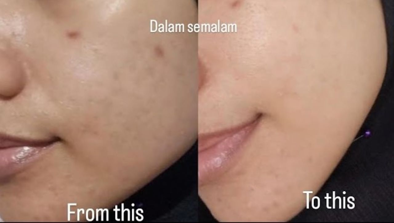 Beauty Hack Mencerahkan Wajah Kusam, Cuma Modal 2 Bahan Alami Saja