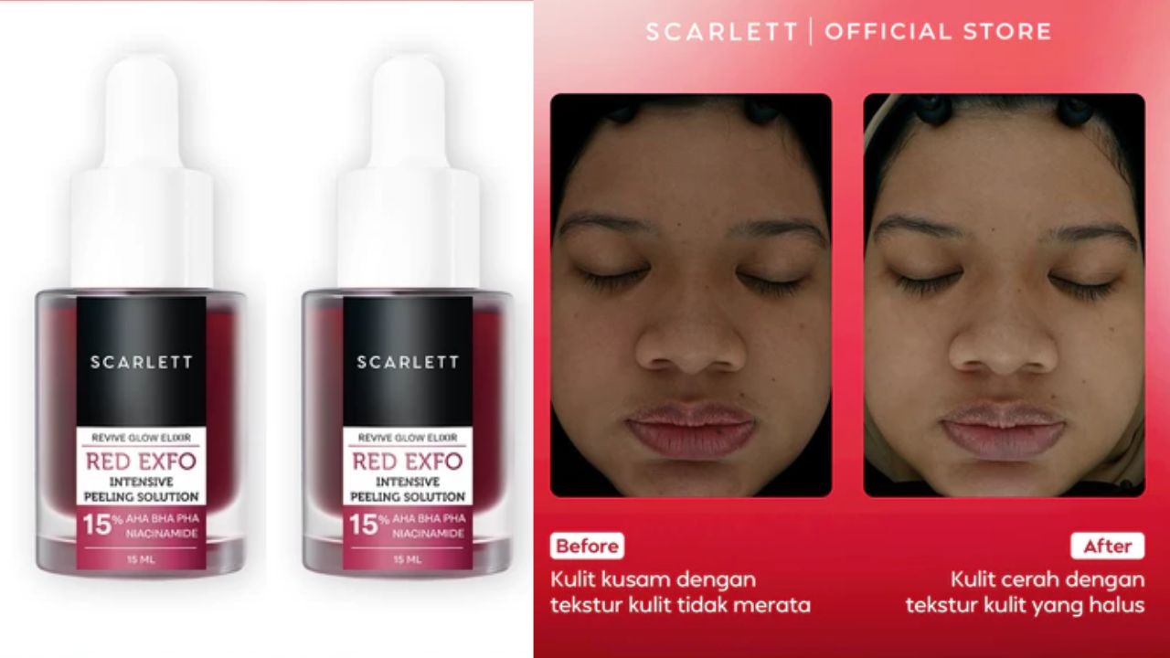 Review Scarlett Red Exfo Intensive Peeling Solution, Beneran Bikin Kulit Lebih Cerah?