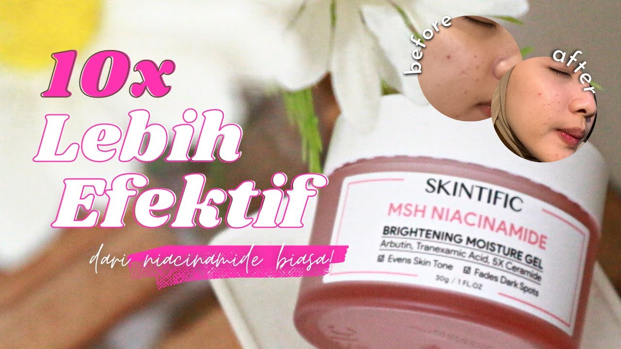 Review Jujur Moisturizer Pencerah Wajah Skintific MSH Niacinamide, Bikin Kulit Lebih Bersinar