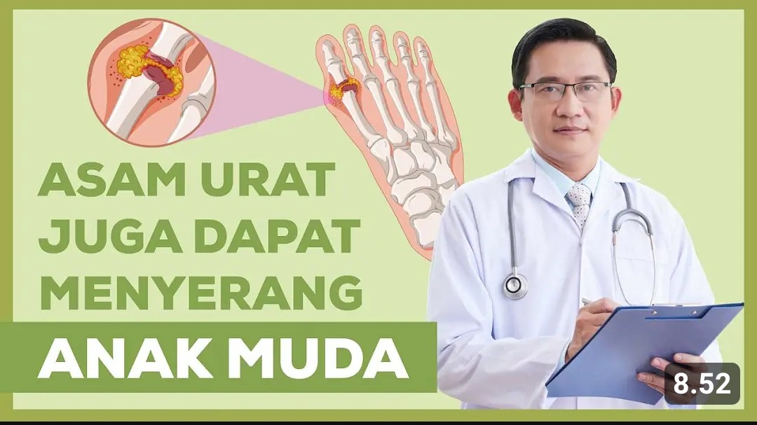 Inilah 5 Ciri-ciri Sakit Asam Urat di Usia Muda Wajib Diwaspadai