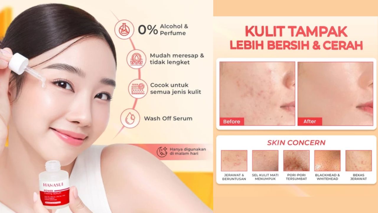 Mulai Rp20 Ribuan! 4 Rekomendasi Peeling Serum dari Berbagai Merk, Rahasia Kulit Cerah dan Halus 
