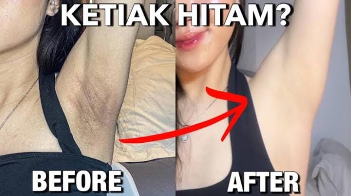 Ini Dia 5 Deodoran Pemutih Ketiak Paling Ampuh di Indomaret dan Alfamart, Gak Bikin Keti Hitam dan Kasar