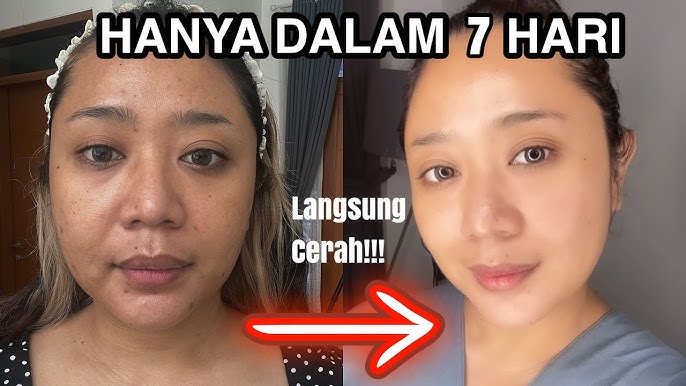 3 Cara Memutihkan Wajah dengan Bahan Alami di Dapur, Bikin Glowing Bebas Flek Hitam di Usia 40 Tahun Ke Atas