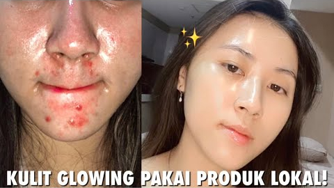 Inilah Cara Menggunakan Air Mawar yang Benar, Flek Hitam dan Kerutan Hilang Wajah Glowing Bebas Jerawat