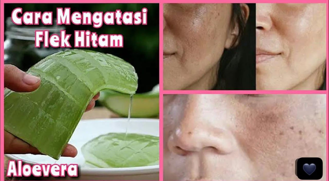 3 Cara Mengelupas Flek Hitam Dengan Lidah Buaya Agar Wajah Glowing, Cuma Pakai 2 Bahan Dapur