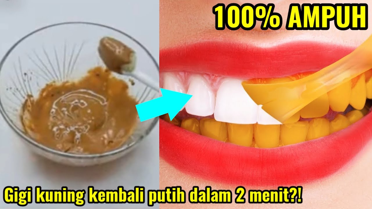 4 Cara Mudah Memutihkan Gigi Kuning Secara Alami, Bisa Dilakukan Sendiri di Rumah