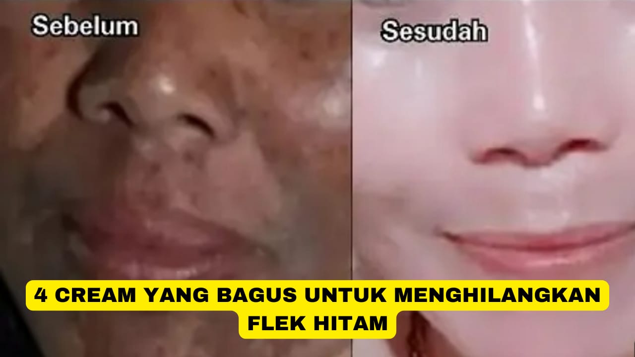 4 Cream yang Bagus untuk Menghilangkan Flek Hitam Agar Wajah Glowing, Kulit jadi Kencang Awet Muda!