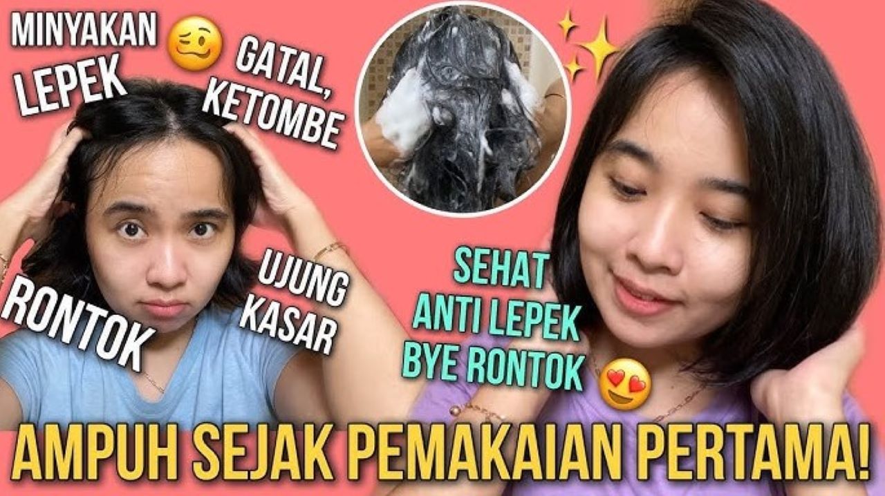 Cara Mengatasi Ketombe dan Rambut Rontok Sekaligus, Campurkan Shampo dengan 3 Bahan Ini