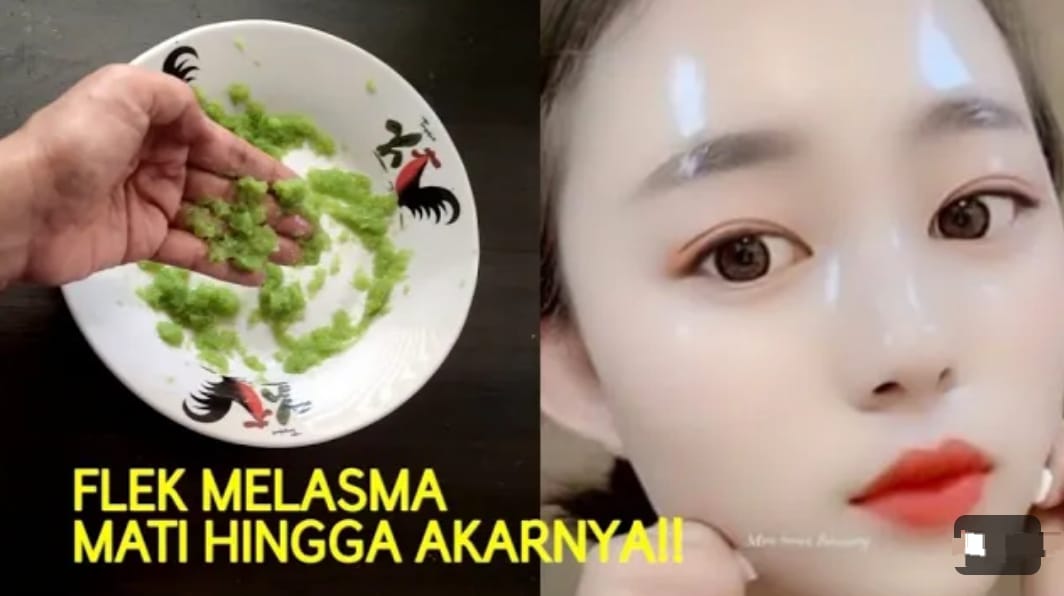 3 Cara Menghilangkan Melasma Secara Alami Dalam Semalam, Bantu Hilangkan Flek Hitam Pori Besar dan Kerutan