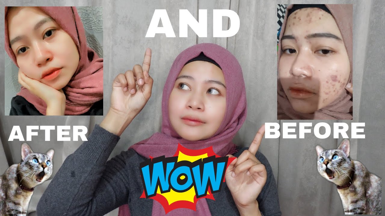 3 Cara Meracik Masker Eksfoliasi dari Bahan Alami untuk Mencerahkan Kulit