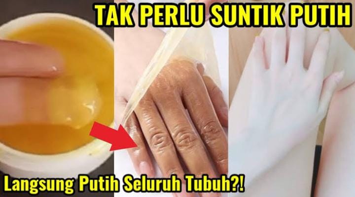 Cara Memutihkan Kulit Tangan Dan Kaki Dengan Cepat Dan Alami Cuma Pakai 2 Bahan Dapur Bikin 4377