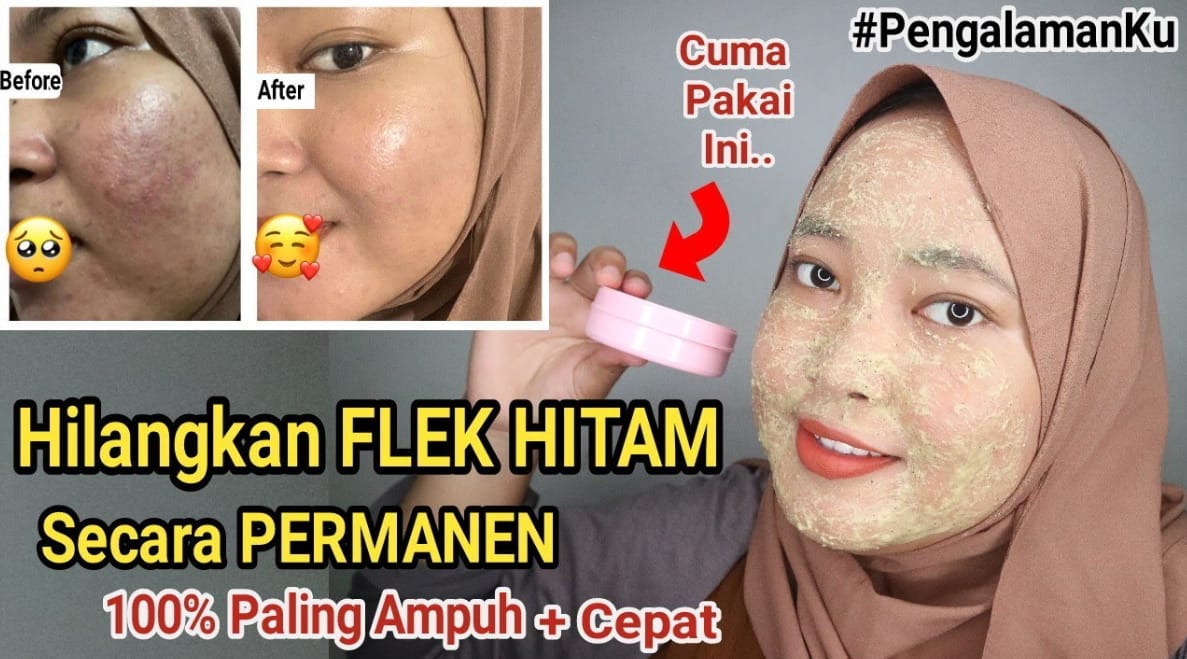 3 Cara Membuat Campuran Masker Lidah Buaya dan Minyak Zaitun untuk Wajah, Sekali Usap Flek Hitam Rontok