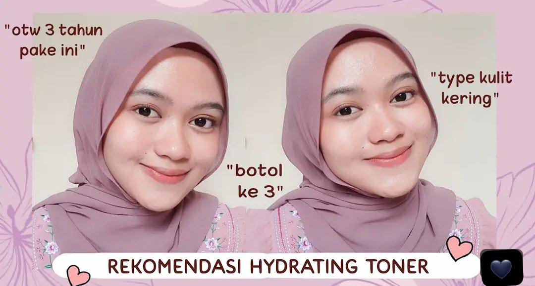 4 Produk Toner untuk Kulit Kering dan Kusam Terbaik Agar Cerah dan Glowing Setiap Saat