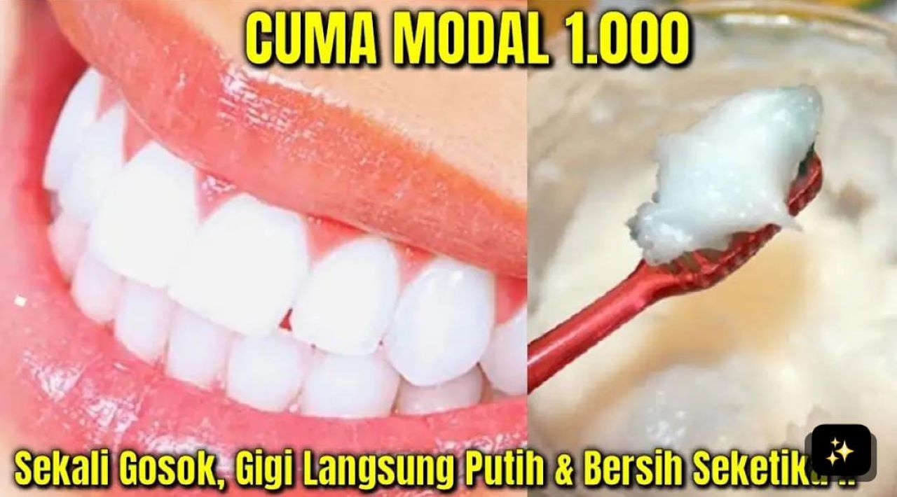 Tidak Pakai Baking Soda, Ternyata ini 3 Cara Memutihkan Gigi Kuning Secara Permanen Cuma Pakai 1 Bahan