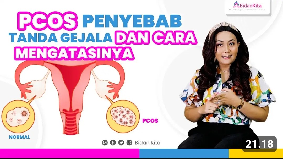 4 Faktor Penyebab Wanita Kena PCOS, Benarkah Karena Suka Makan-makanan Manis?