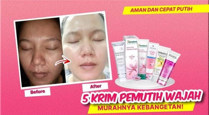 5 Cream Pemutih Wajah Terbaik yang Mencerahkan Secara Instan dan Menutrisi Kulit Agar Awet Muda