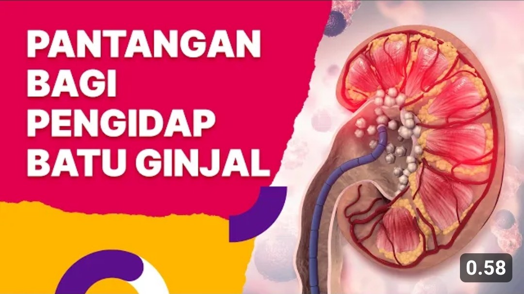 7 Pantangan Penyakit Ginjal yang Harus Dijalani agar Kadar Kreatinin Turun