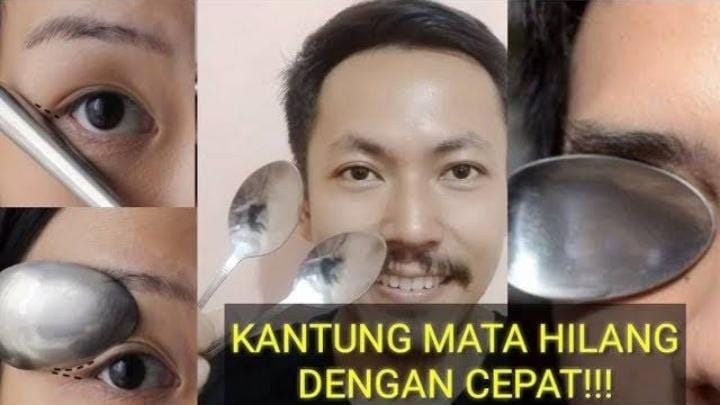 Cara Menghilangkan Kantung Mata dengan Sendok, Lingkaran Hitam Hilang Permanen dalam 5 Langkah Tanpa Operasi