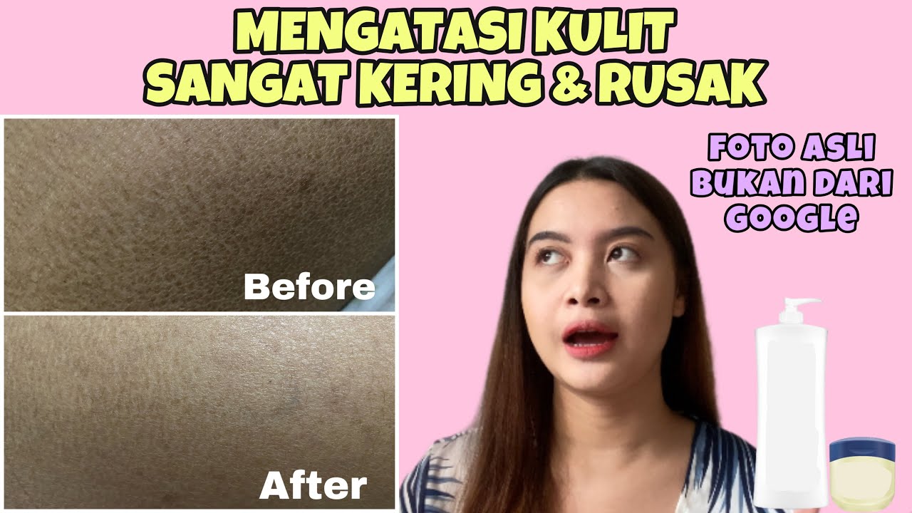 5 Rekomendasi Handbody untuk Kulit Kering dan Bersisik Terbaik! Kulit Auto Lembap dan Bebas Koreng